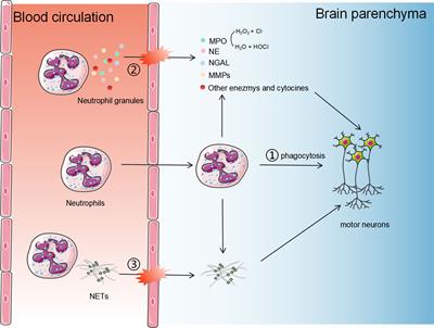 Neutrophils: a subgroup of neglected immune cells in ALS
